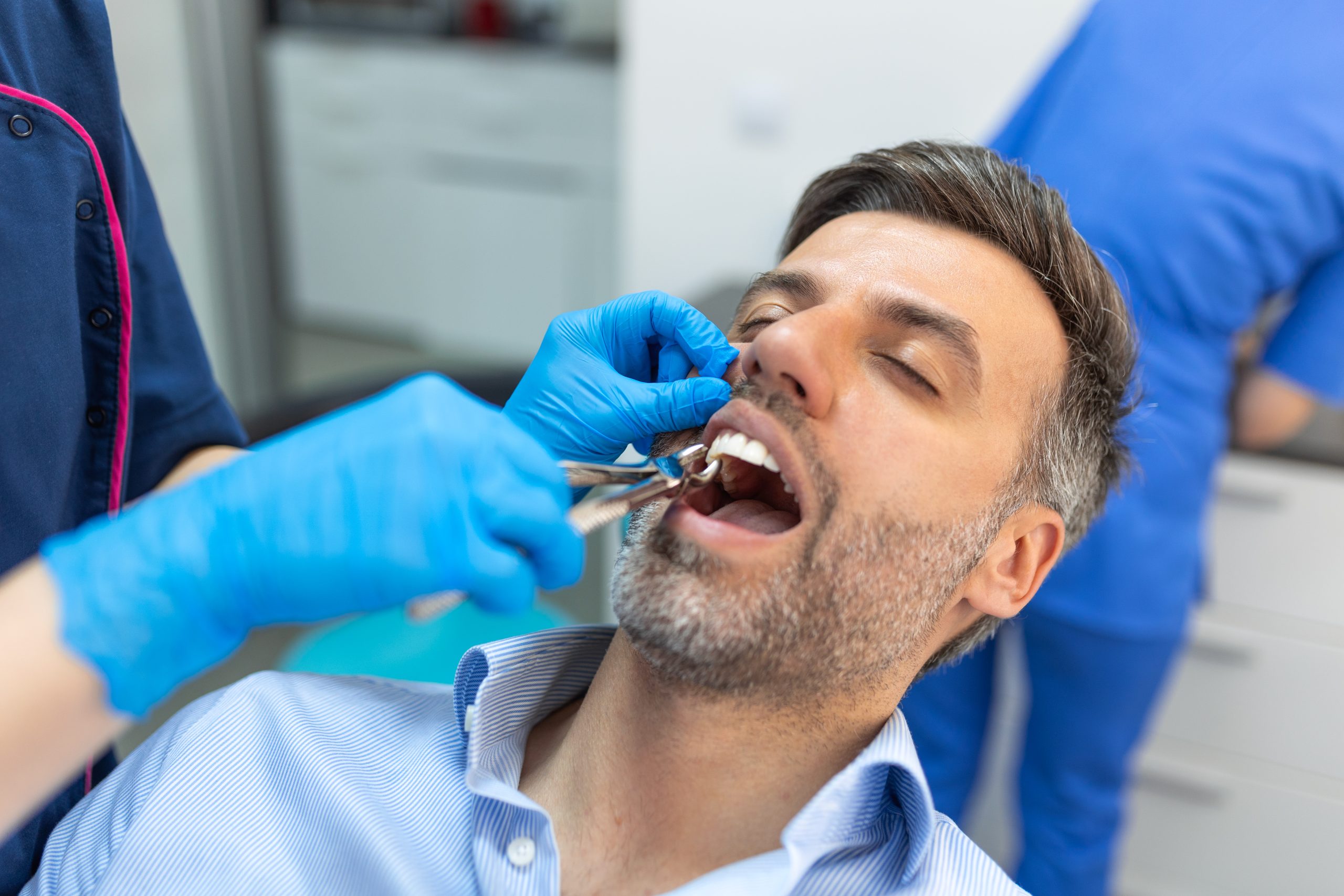 Tooth Removal at Pure Smile Dental Clinic in Dubai - UAE
