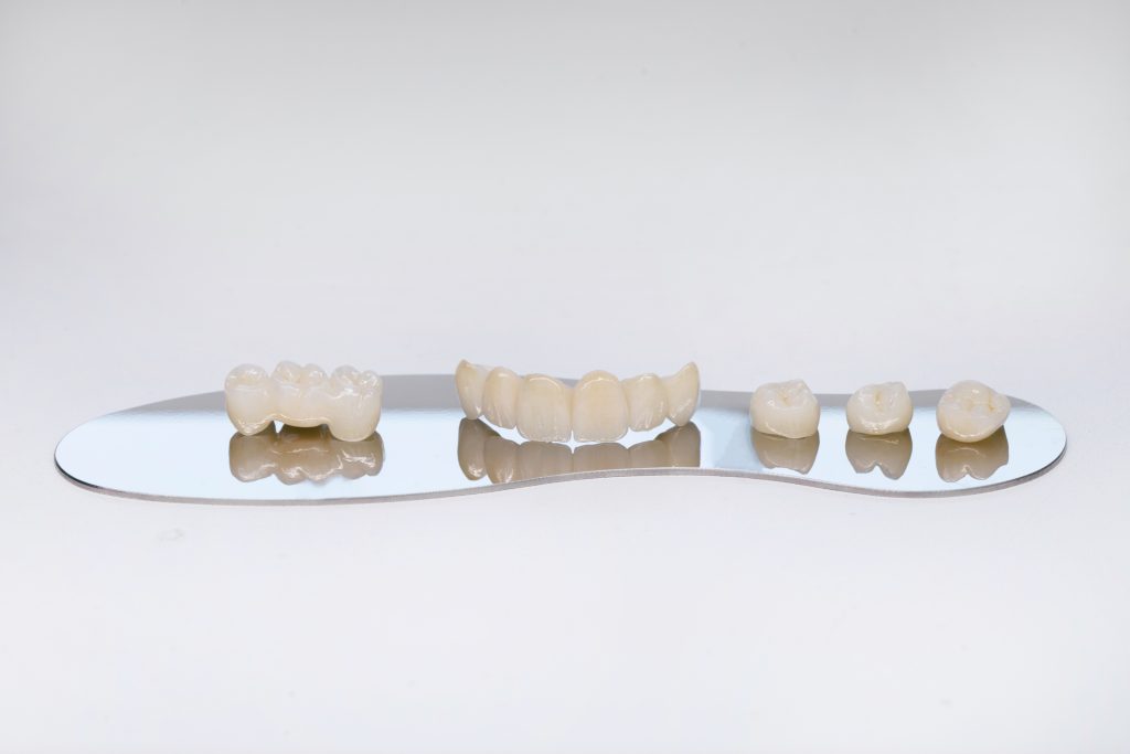 dental bridge